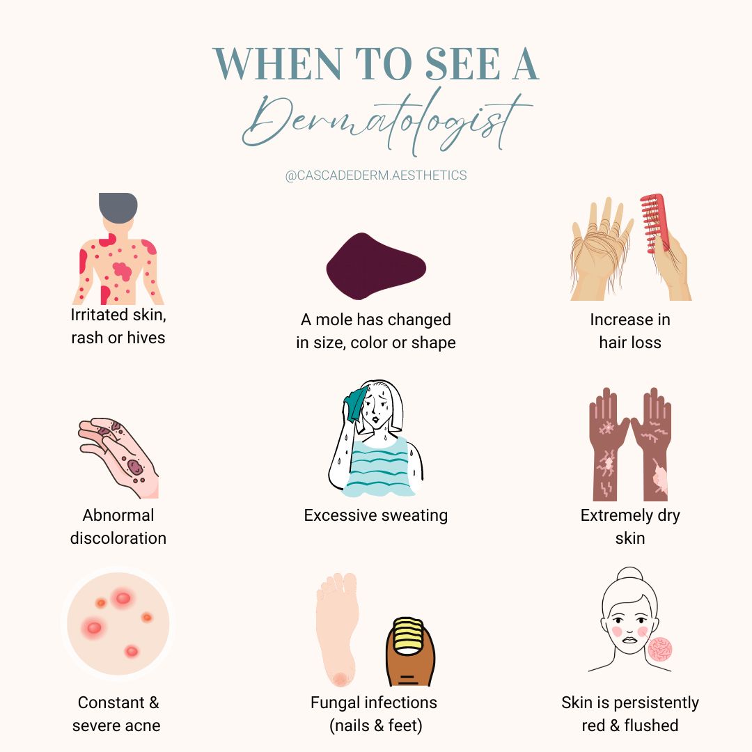 9 Signs Its Time To Visit A Dermatologist