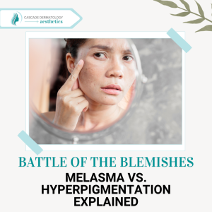 battle of the blemishes melasma vs hyperpigmentation explained
