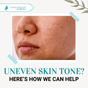 a woman with uneven skin tone and dark spots on the face
