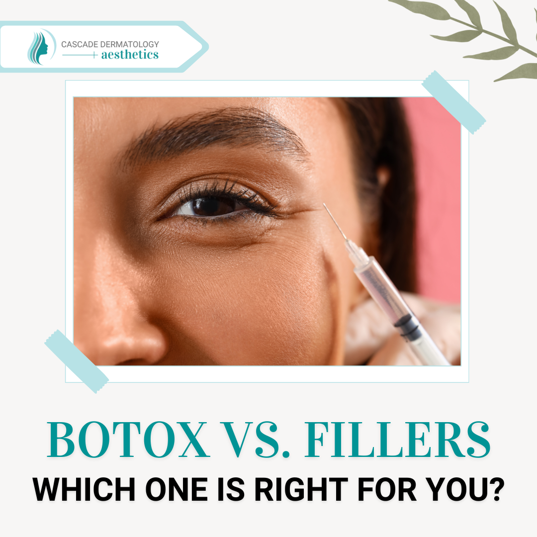 graphic that says botox vs fillers which one is right for you