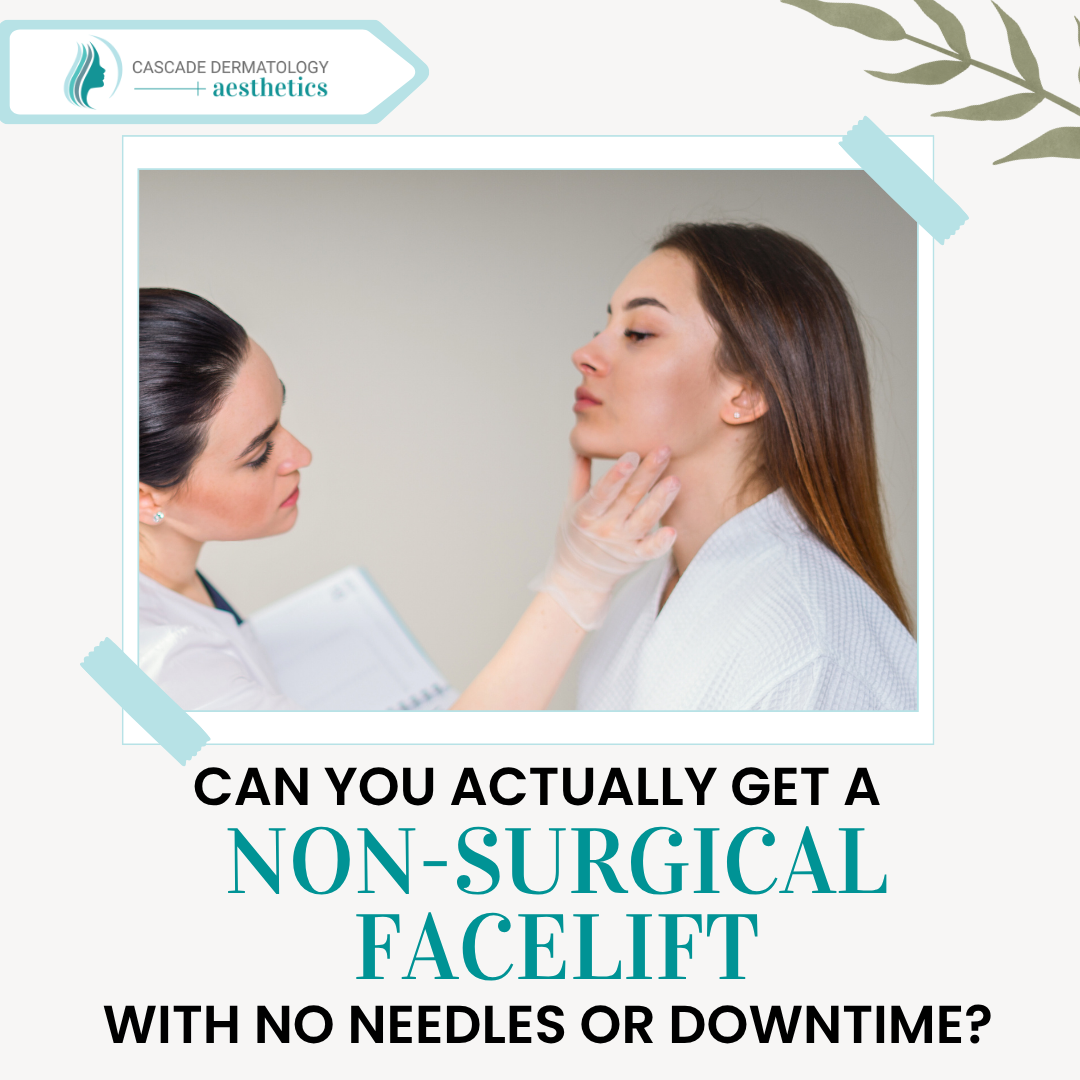 nonsurgical facelift prx derm perfexion